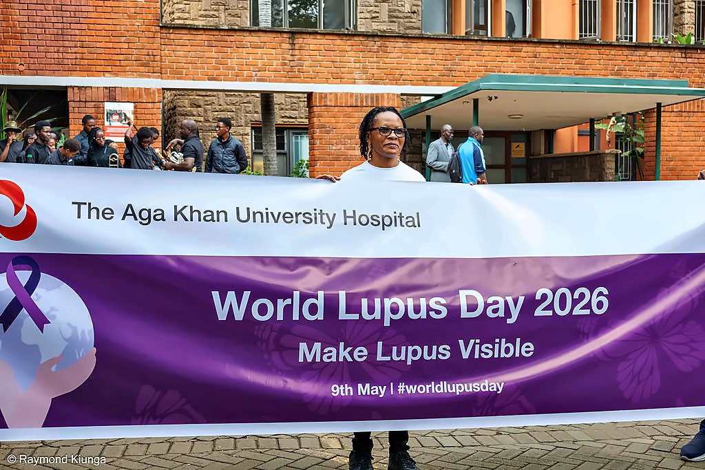 The World Lupus Day 2026 banner reading Make Lupus Visible at the Aga Khan University Hospital, Nairobi